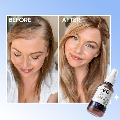 Feg Plus Hair Growth Spray – Stimulate Follicles, Reduce Hair Fall, And Encourage Thicker, Healthier Growth 60ml