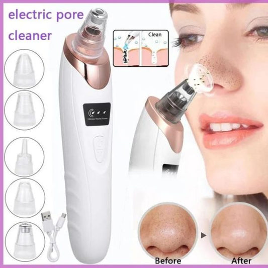 Blackhead Remover Vacuum Acne Cleaner Black Spots Removal Facial Deep Cleansing Pore Cleaner Machine