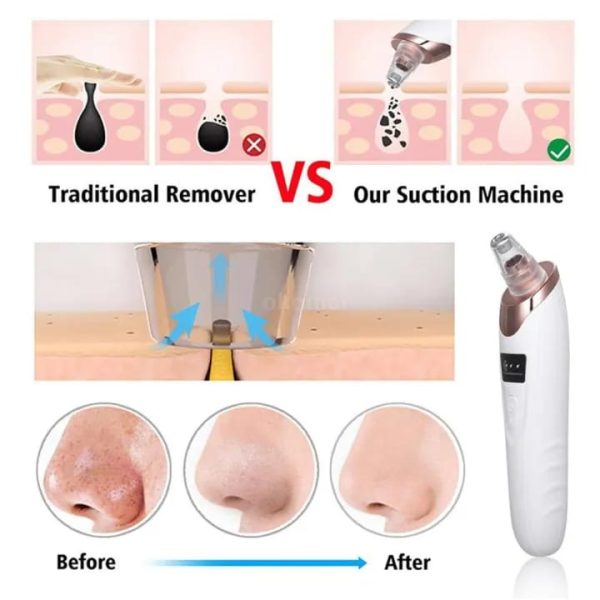 Blackhead Remover Vacuum Acne Cleaner Black Spots Removal Facial Deep Cleansing Pore Cleaner Machine