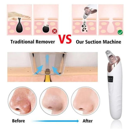 Blackhead Remover Vacuum Acne Cleaner Black Spots Removal Facial Deep Cleansing Pore Cleaner Machine